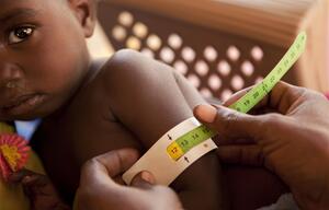 Mangelernährung, UNICEF
