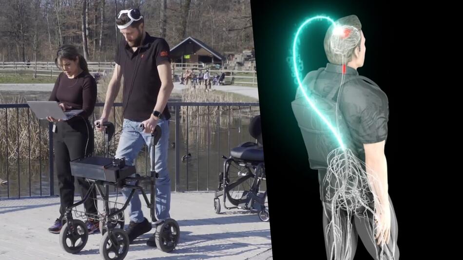 Con la forza del pensiero: una persona paralizzata può camminare di nuovo grazie all'intelligenza artificiale
