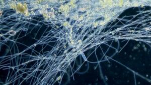 Blaualgen: Das müssen Sie wissen