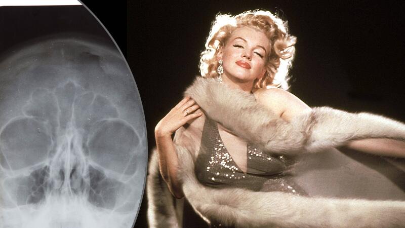 Marilyn Monroe und eine Röntgenaufnahme von ihrem Gesicht.