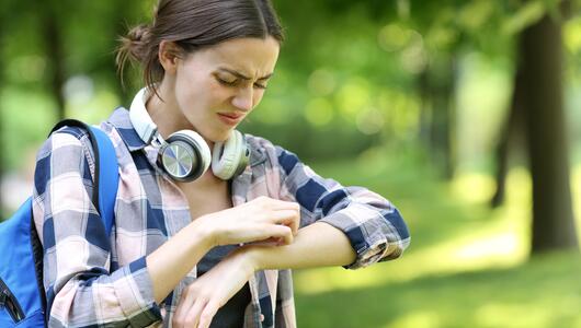 Mückenstich (Symbolfoto).