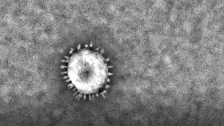 Borna-Virus