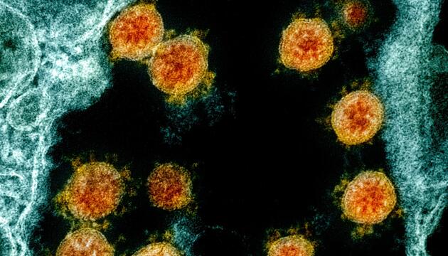 Coronavirus - Mikroskopische Aufnahme