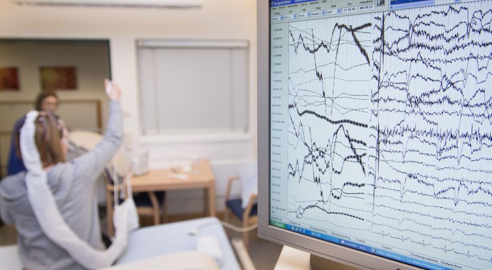 Impulse von Elektroden zur Messung von Gehirnströmen