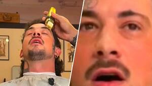 Schlechtes Timing: Kurze Bewegung kostet Mann halbe Augenbraue