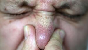 Gestank in Karlstein