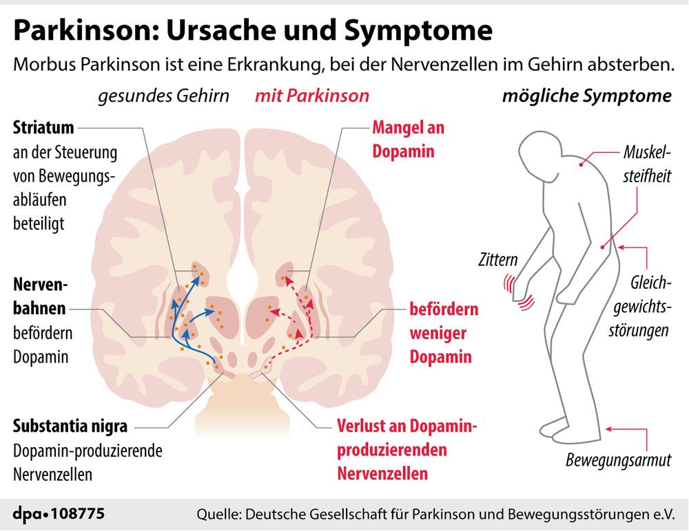 Infografik: Ursache und Symptome von Parkinson
