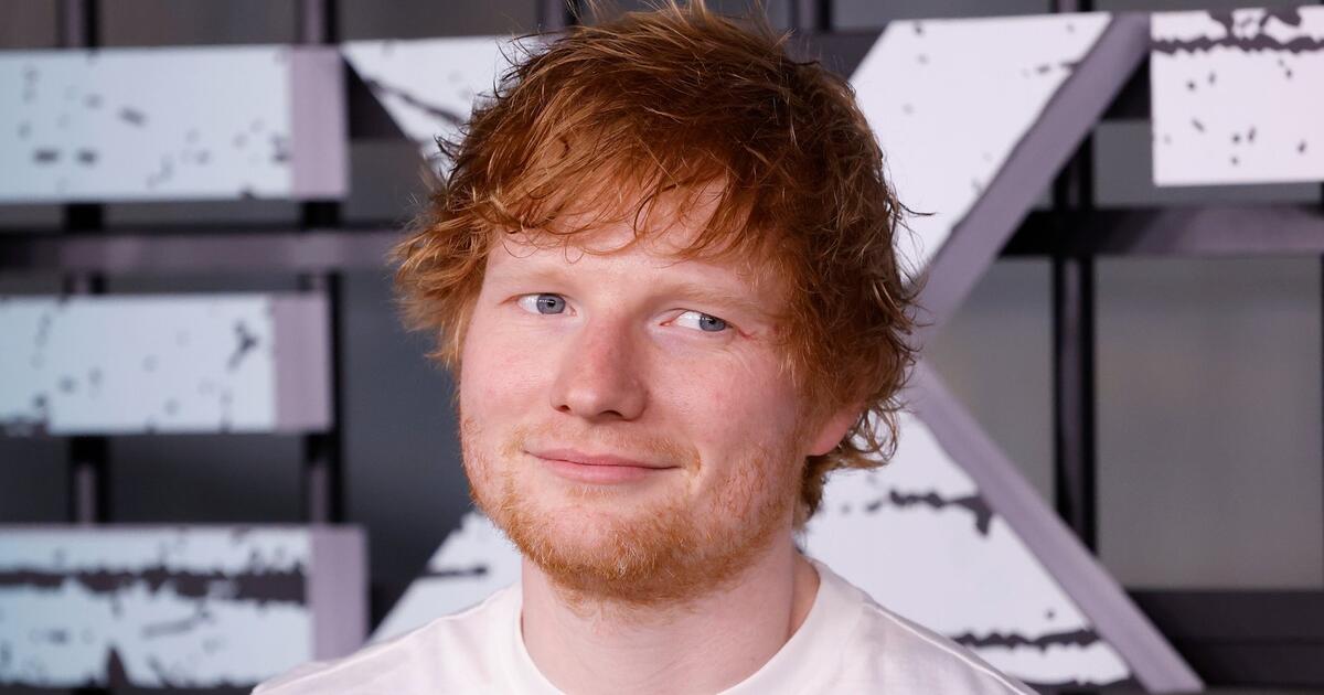 Ed Sheeran rasiert sich die Haare: „Ich liebe es und behalte es so“ — image 1