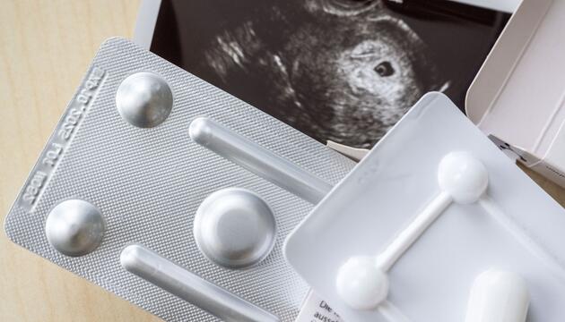 Schwangerschaftsabbruch in Frauenarztpraxis