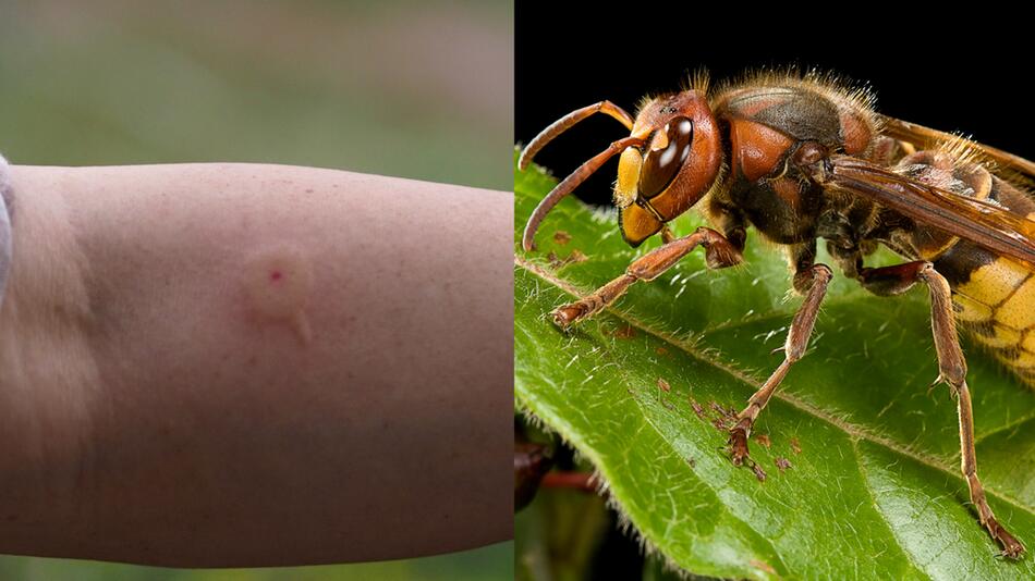 Viele Hornissen unterwegs: Das sollten Sie bei einem Hornissen-Stich beachten