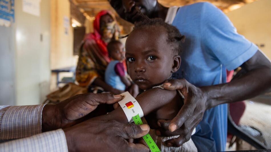 Einem Kind wird der Oberarmumfang gemessen, um den Grad der Mangelernährung festzustellen