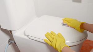 Dieses Drogerieprodukt hilft gegen Verfärbungen am WC-Sitz
