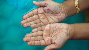 Schrumpelige Hände im Wasser