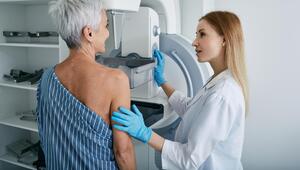 Ältere Frau bei der Mammographie