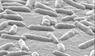Pseudomonas-aeruginosa-Bakterien