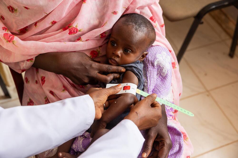 Foto eines Kindes, das auf Unterernährung untersucht und behandelt wird
