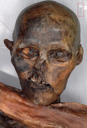 Detailaufnahmen von Ötzi im Internet