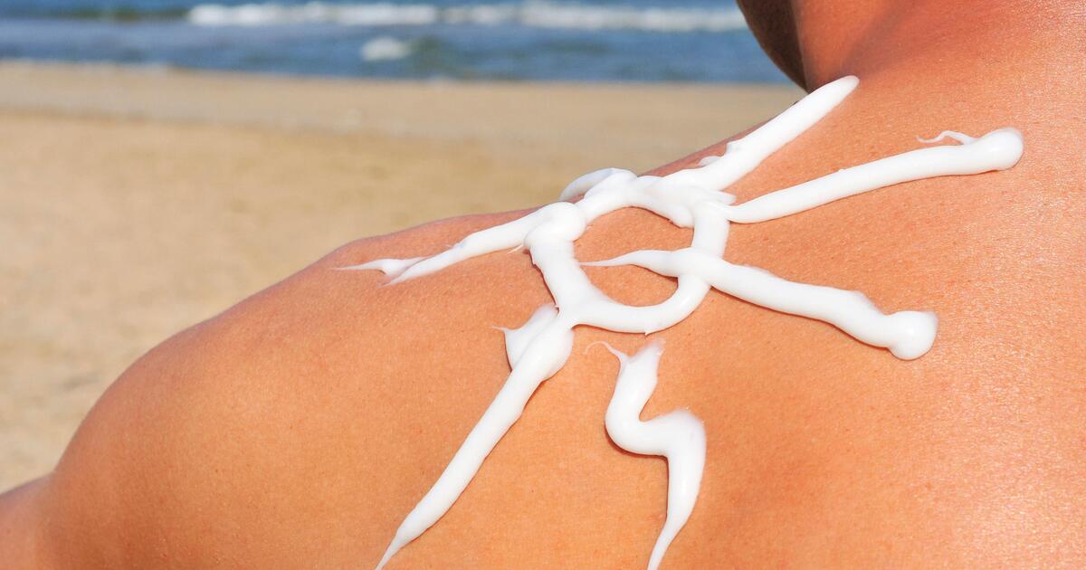 Aloe Vera, Quark und mehr: Die besten Hausmittel gegen Sonnenbrand | WEB.DE